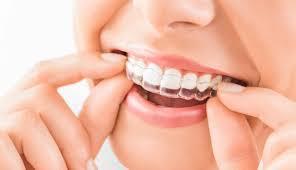Orthodontiste casablanca